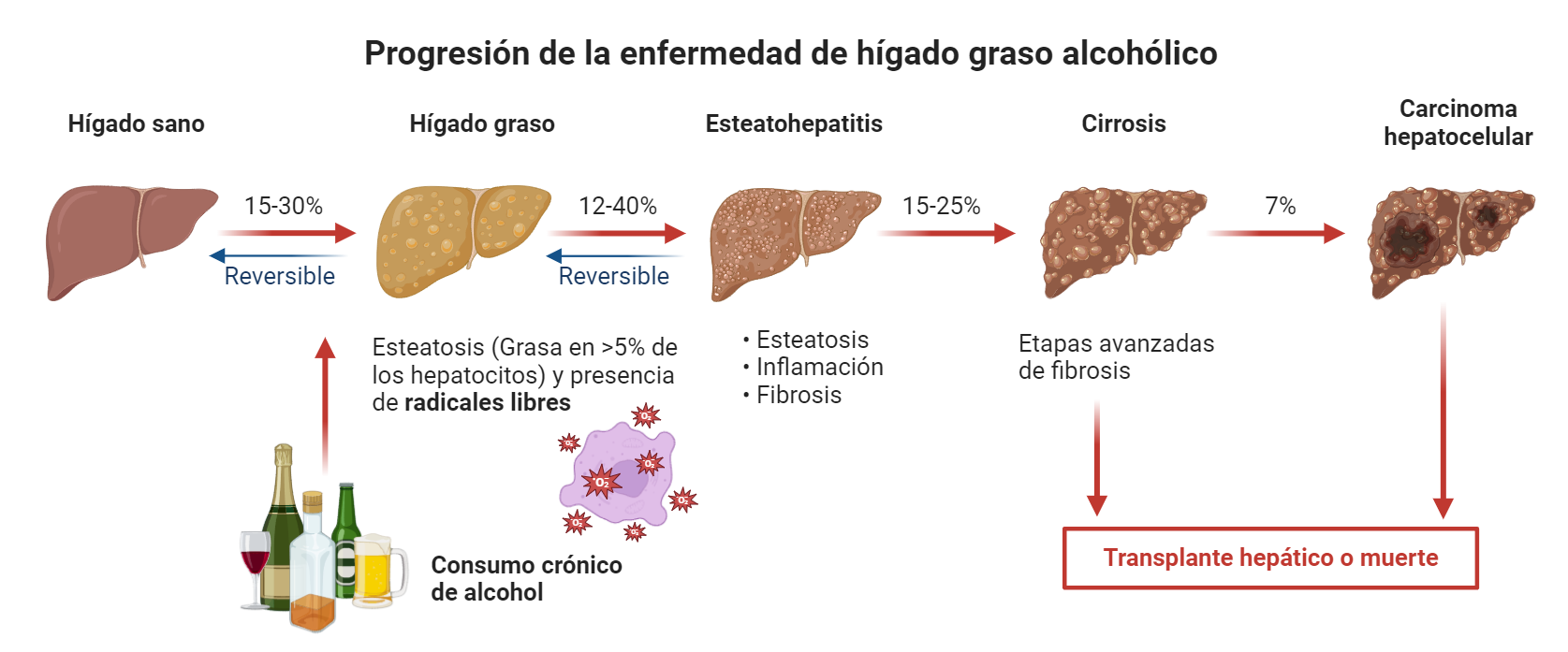Progresión de la enfermedad de higado graso alcohólico